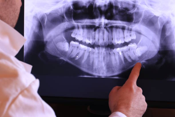 Best Broken or Chipped Tooth Repair in Madrid, IA